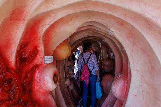 Begehbares Darmmodell