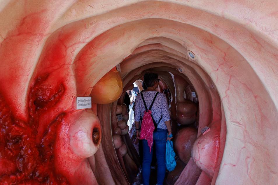 Begehbares Darmmodell